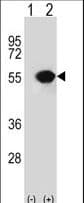 TIP49 / RUVBL1 Antibody