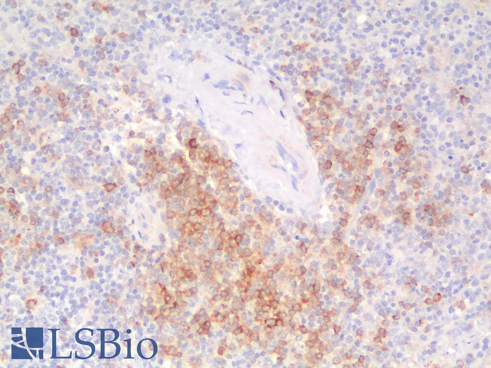 PathPlus™ CD79A / CD79 Alpha Antibody (aa202-216, clone IGA/1790R)