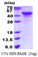 Human NDRG2 Protein (Recombinant His)