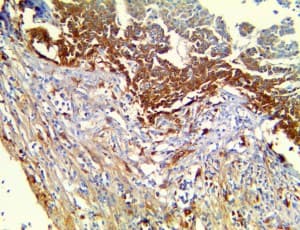 TTR / Transthyretin Antibody