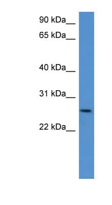 Polyclonal Rabbit anti-Mouse CHODL / Chondrolectin Antibody (aa161-210, WB)
