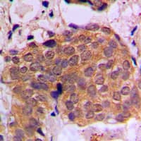 RAN Antibody (C-Terminus)