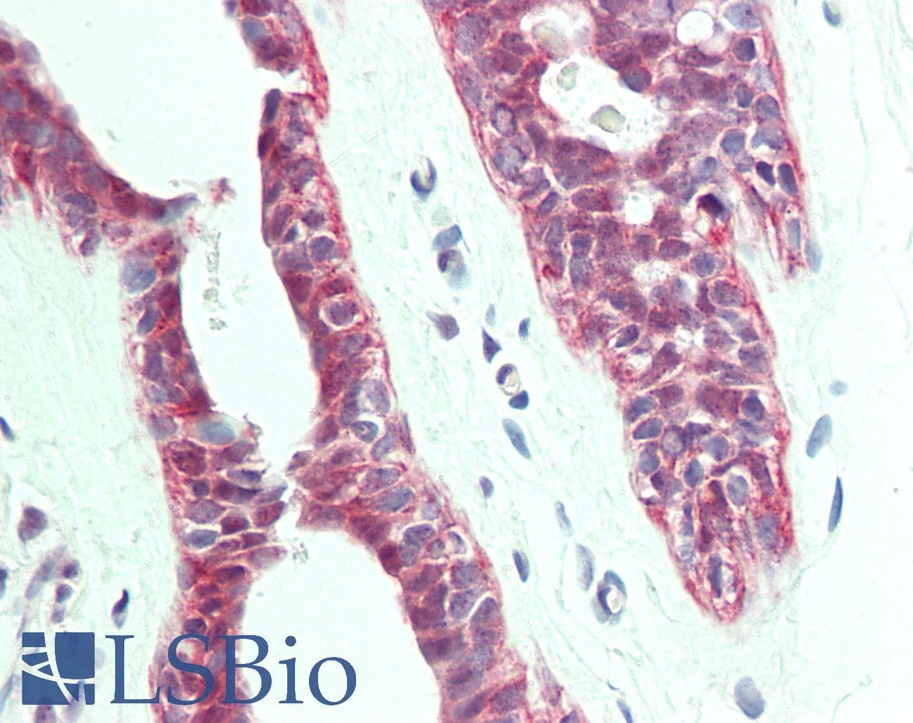 IHC-plus™ HACD1 / PTPLA Antibody (aa37-66)