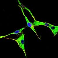 ADRBK1 / GRK2 Antibody (clone 3F8)