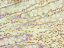 KCTD15 Antibody (aa1-234)