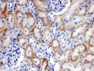 Polyclonal Rabbit anti-Human SLC22A2 Antibody (IHC, WB)