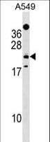 Polyclonal Rabbit anti-Human EFHD1 Antibody (aa68-94, WB)