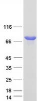 Human NVL Protein (Recombinant Myc-DDK (Flag))