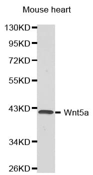 Polyclonal Rabbit anti-Human WNT5A Antibody (IHC, WB)