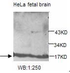 MMS2 / UBE2V2 Antibody