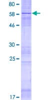 Human HACD3 / PTPLAD1 Protein (Recombinant GST)