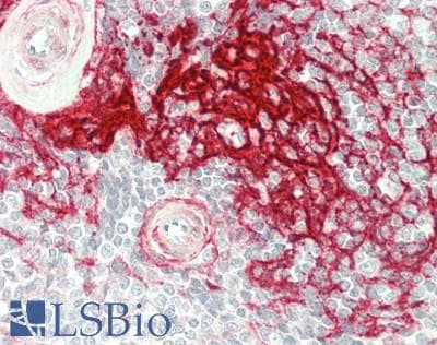 IHC-plus™ Complement C4d Antibody (clone SPM545, Azide-free, BSA-free)