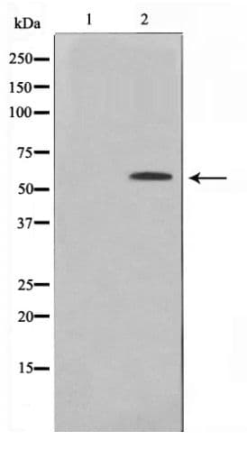 Polyclonal Rabbit anti-Human TP53 / p53 Antibody (phospho-Ser20, WB)