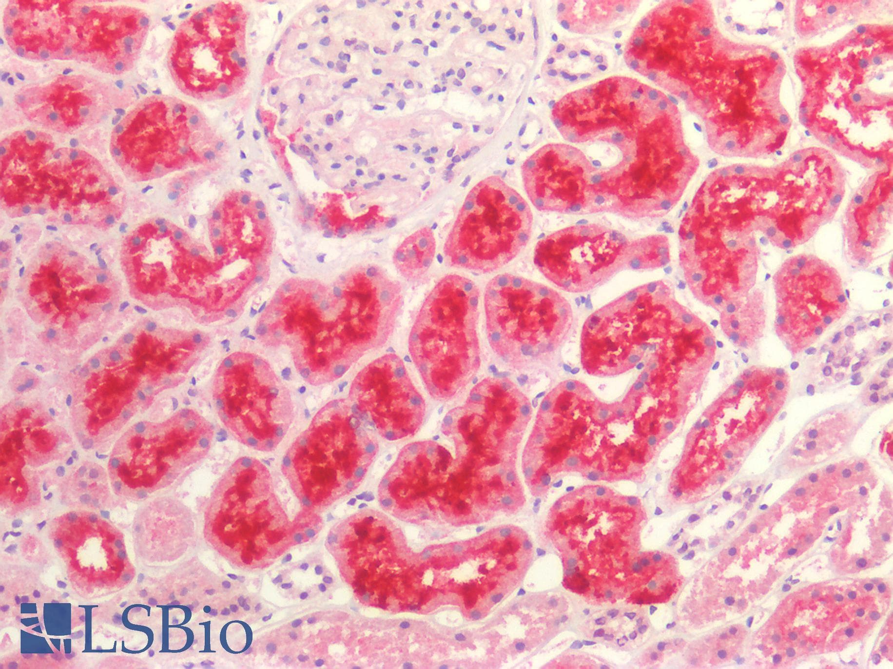 IHC-plus™ SLC5A2 / SGLT2 Antibody (clone 3G8)