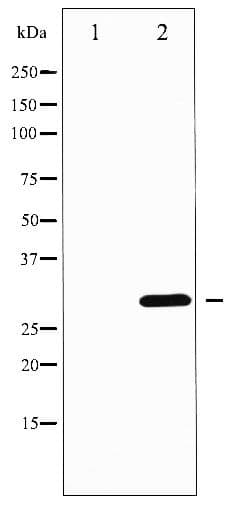 PPP1R1B / DARPP-32 Antibody (phospho-Thr75)
