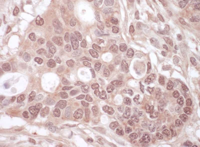 p84 / THOC1 Antibody (aa550-600)