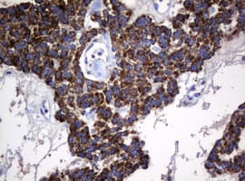 HSPD1 / HSP60 Antibody (clone OTI6F7)