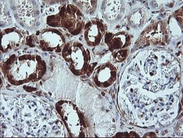 Monoclonal Mouse anti-Human LGALS3 / Galectin 3 Antibody (clone 1G8, Carrier-free, IHC, IF, WB)