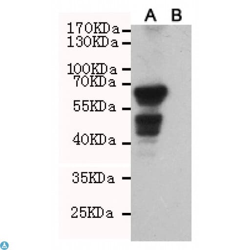 AKT1 Antibody