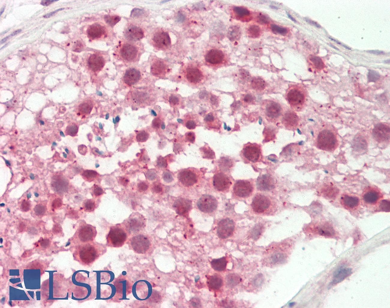 YWHAQ / 14-3-3 Theta Antibody (aa45-94)