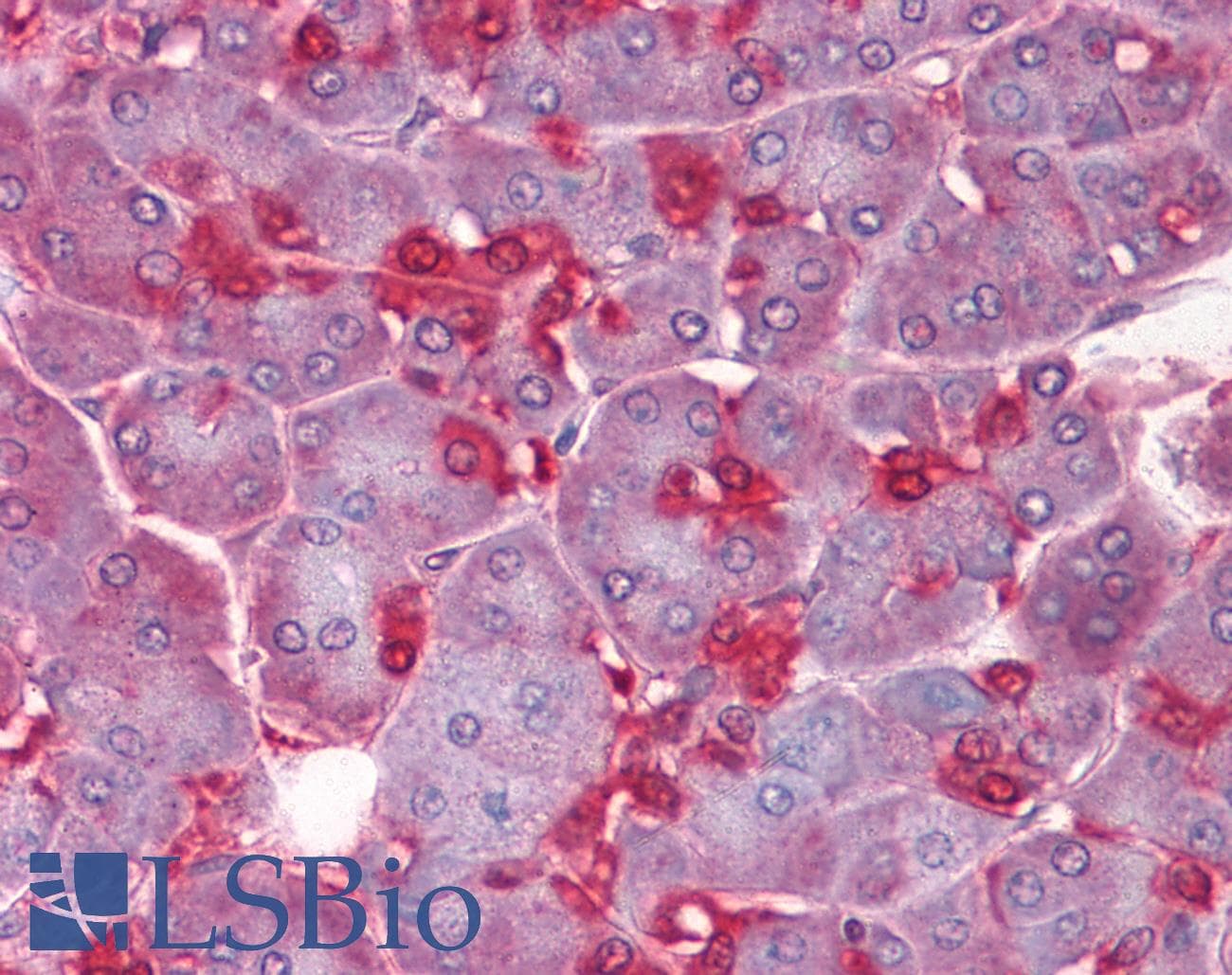 PathPlus™ ENO1 / Alpha Enolase Antibody (clone 8G8)