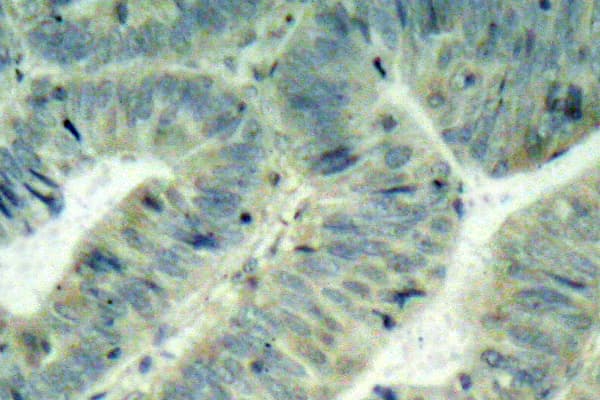Polyclonal Rabbit anti-Human SRC Antibody (phospho-Tyr418, IHC, WB)