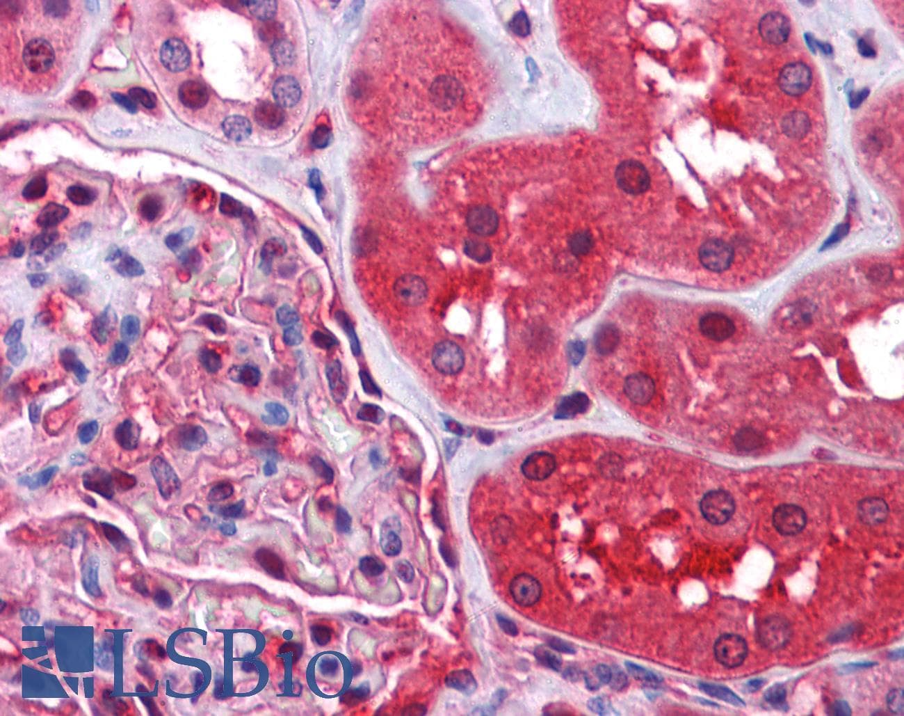 IHC-plus™ RDX / Radixin Antibody (aa537-548)