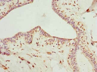 SCGB2A2 / Mammaglobin A Antibody