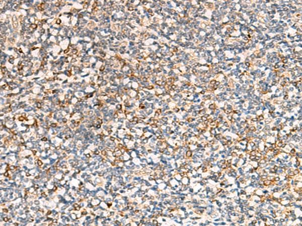 SEC22B Antibody