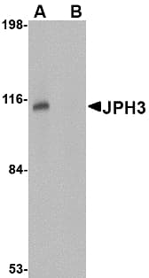 IHC-plus™ JPH3 Antibody