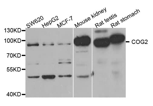 Polyclonal Rabbit anti-Human COG2 Antibody (IHC, WB)