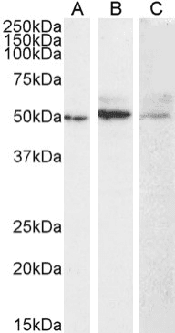 Recombinant Monoclonal Mouse anti-Human MMP14 Antibody (clone LEM-2/15, Membrane type 1 metalloprotease)
