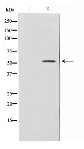 HNF4 Alpha+Gamma Antibody