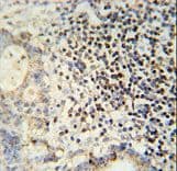 Polyclonal Rabbit anti-Human ESRP1 / RBM35A Antibody (aa182-211, IHC, WB)