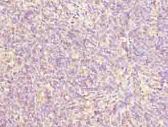 ZNF131 Antibody