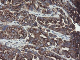 GCP60 / ACBD3 Antibody (clone OTI1B5)
