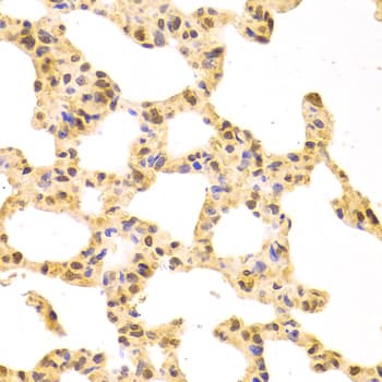 SRSF1 / SF2 Antibody