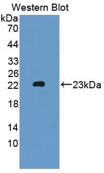 Polyclonal Rabbit anti-Mouse MTMR9 Antibody (aa1-167, WB)