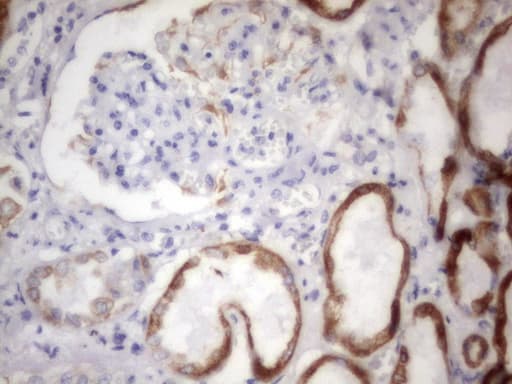 Acidic Cytokeratin Antibody (clone 8F5)
