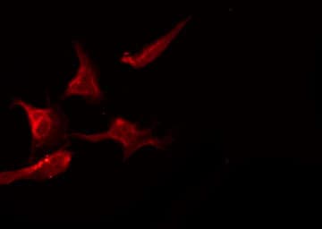 SCN2B Antibody