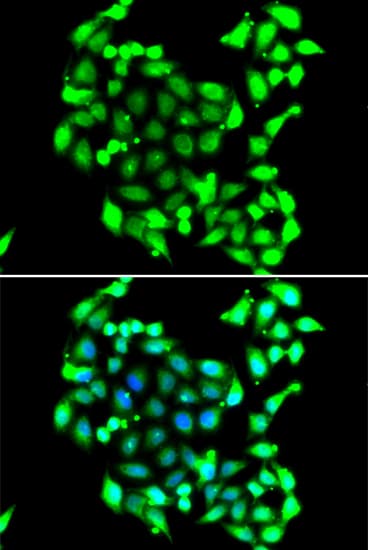 Polyclonal Rabbit anti-Human GTF2H3 Antibody (IHC, IF, WB)