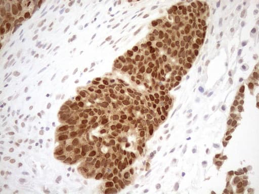 MGMT Antibody (clone OTI6C4)