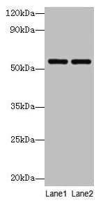PHGDH Antibody