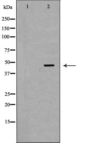 Polyclonal Rabbit anti-Human CD121b / IL1R2 Antibody (IHC, IF, WB)