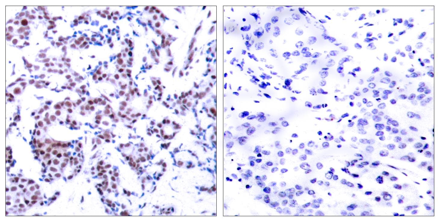 Polyclonal Rabbit anti-Human JUNB / JUN-B Antibody (phospho-Ser259, IHC, WB)