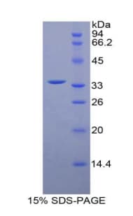 Mouse MYLK4 Protein (Recombinant His-T7)