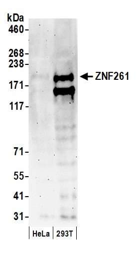 Polyclonal Rabbit anti-Human ZMYM3 Antibody (aa250-300, IHC, WB)