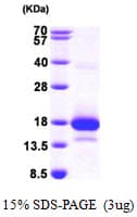 Human GLOD2 / MCEE Protein (Recombinant His)