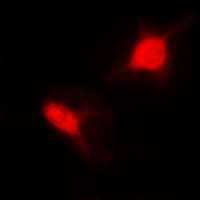 Polyclonal Rabbit anti-Human SNRPD2 Antibody (IHC, IF, WB)