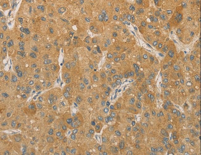 Polyclonal Rabbit anti-Human PRPSAP1 Antibody (IHC)